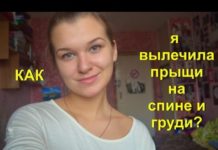 Черные точки на грудине и сосках у женщин