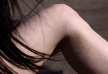 Аллергия в виде гусиной кожи и причины: на руках, ногах у взрослого и ребёнка