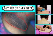 Чем лечить черные точки шее