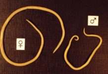 Высыпания на коже при глистах у детей и сыпь при гельминтах