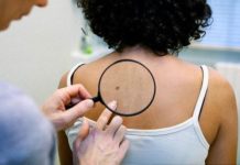 Красные пятна на теле при раке (фото)