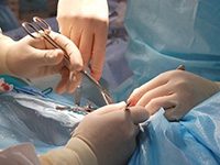 Лечение липомы народными средствами: удаление жировика на спине под кожей