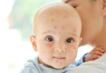 Температура 37 и сыпь у годовалого ребенка