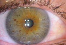 Черные точки в глазах: что это такое, причины возникновения и особенности лечения