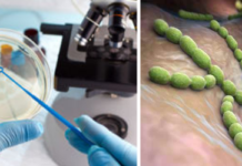 Гнойнички на члене: причины и лечение