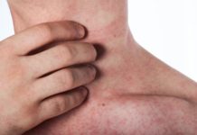 Геморрагическая сыпь: фото, причины и лечение