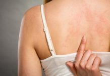 Мелкая сыпь на теле у взрослого: возможные причины и методы лечения