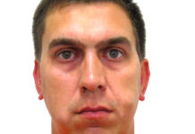 Жировики на лице: фото, причины, как быстро избавиться