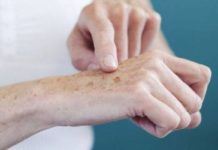 Черные точки на руках: причины, как избавиться