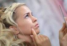 Акне (угревая сыпь, угри на теле)