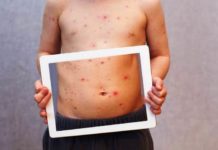 Аллергическая сыпь у взрослых: фото симптомы и лечение