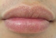 Почему чешутся ноги ниже колен: причины у женщин и мужчин, чем лечить