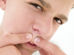 Чем лечить прыщи у мальчиков-подростков: как избавиться — лучшие средства на лице, лечение угрей у парней