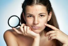 Как убрать прыщи на лице у подростка: можно и нельзя