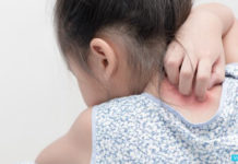 Сыпь у ребенка без температуры и зуда, сыпь с зудом: что делать |