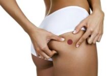 Фурункул (в народе «чирей») на ягодице: как лечить народными средствами и мазями в домашних условиях