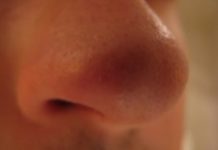 Фурункул в носу: 5 способов как лечить чирей, что делать в домашних условиях