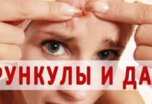Фурункулы при диабете: лечение, последствия, симптомы