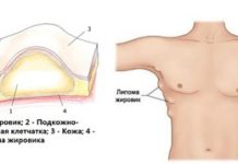 Жировик: к какому врачу обратиться. К каким врачам идти при болях и осложнениях