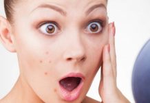 Водянистые прыщи на лице, на носу и губе – причины появления и способы лечения, профилактика