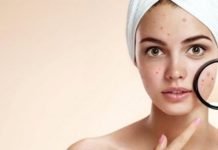 Гнойные прыщи на лице – почему появляются высыпания и как избавиться от них: причины и лечение