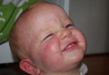 Сыпь на лице у новорожденных: причины, ТОП методов лечения