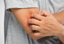 Сыпь на локтях и коленях: почему чешутся и появились пупырышки? Высыпания и раздражение у взрослого, причины прыщей у ребенка на локтевом сгибе и ногах |