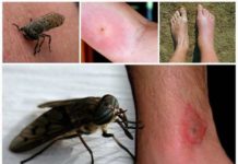 Народные средства от аллергии на коже у взрослых: избавление от зуда и пятен |