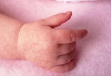 Сыпь на руках у ребенка (25 фото): причины мелких высыпаний с пояснениями, между пальцами