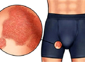 Покраснения в паху у мужчин — фото, причины, лечение