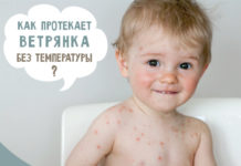 Ветрянка без температуры у детей: симптомы и лечение