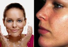 Лучшее средство от черных точек, обзор популярных препаратов