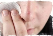 Простудные прыщи на лице — лечение, на теле, носу, причины, фото