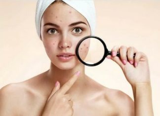 Почему перед месячными прыщи на лице и подбородке и как бороться?