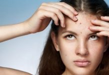 Болючие прыщи на лице – причина появления, почему болят, как избавиться и чем лечить, обзор средств