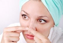 Выдавливание черных точек: можно ли удалять угри на лице руками |