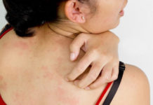 Сифилис на коже: фото, симптомы, диагностика и методы лечения