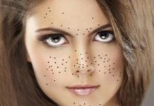 Комедоны на лице: пора обратить внимание на здоровье и экологию