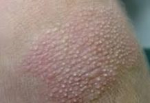 Шершавая кожа у ребенка: причины, что делать | Азбука здоровья