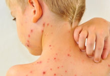 Чешется красная сыпь на теле у взрослого: виды, фото и лечение