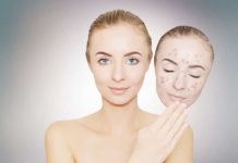 Прыщи после родов на лице – причины появления и способы лечения: лучшие средства и методы