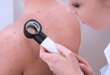 Кожная сыпь теле — как лечить? Причины и лечение кожной сыпи