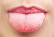 На корне языка ближе к горлу красные пупырышки и прыщи: что это, причины появления бугорков, лечение шишек