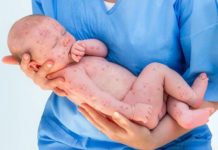 Чем может быть вызвано появление водянистых пузырьков на теле, лице у детей