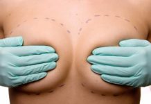 Услуги пластического хирурга. Реконструкция груди