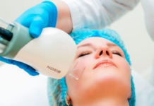 Как работает метода лазерной шлифовки