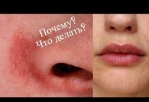 Маска для лица от шелушения кожи: как приготовить в домашних условиях