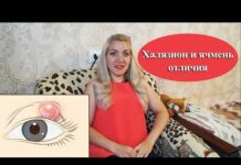 Как избавиться от ячменя на глазу легким способом; Глаза Эксперт