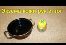 Лечение экземы народными средствами в домашних условиях (сухой, мокрой, монетовидной экземы)