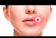 В уголках у рта болит, значит это – ангулит – новости и статьи в регионе Волгоградская область – АптекаМос